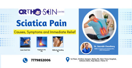 sciatica pain causes, symptoms and immediate relief, what causes sciatica pain, symptoms of sciatica pain, remedies for sciatica pain, sciatica pain treatment, sciatica pain diagnosis, sciatica, herniated disc, buttock pain